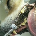 تنظيف الأسنان باستخدام جهاز اولتراسونيك