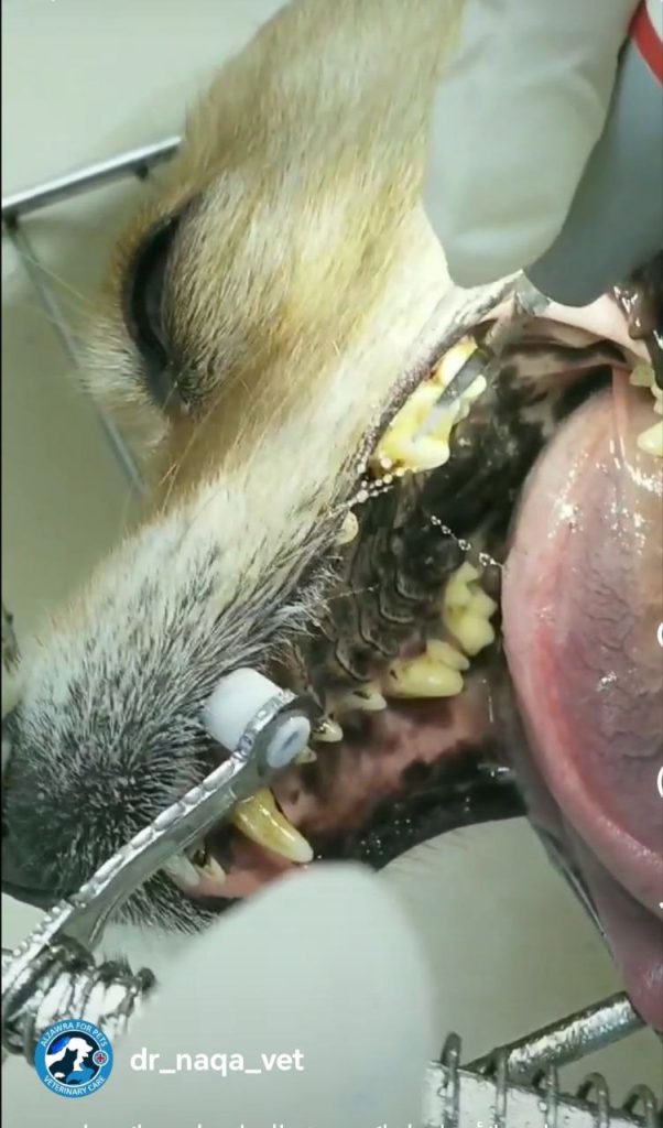 تنظيف الأسنان باستخدام جهاز اولتراسونيك